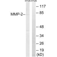 Western blot analysis of extracts from HT-29 cells, using MMP-2 antibody.