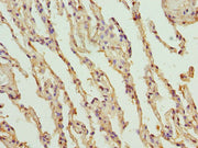 Immunohistochemistry of paraffin-embedded human lung tissue using CSB-PA06329A0Rb at dilution of 1:100