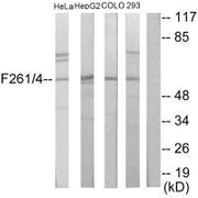 Western blot analysis of extracts from HeLa cells, HepG2 cells, COLO205 cells and 293 cells, using PFKFB1/4 antibody.
