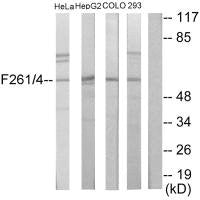 Western blot analysis of extracts from HeLa cells, HepG2 cells, COLO205 cells and 293 cells, using PFKFB1/4 antibody.