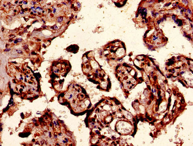Immunohistochemistry of paraffin-embedded human placenta tissue using CSB-PA06337A0Rb at dilution of 1:100