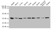 Western blot All lanes: ANXA5 antibody at 2µg/ml Lane 1: HepG2 whole cell lysate Lane 2: Mouse heart tissue Lane 3: Mouse liver tissue Lane 4: Mouse spleen tissue Lane 5: Mouse lung tissue Lane 6: Mouse kidney tissue Lane 7: Mouse brain tissue Lan...