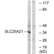 Western blot analysis of extracts from HepG2 cells, using SLC25A21 antibody.
