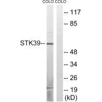 Western blot analysis of extracts from COLO cells, using STK39 (Ab-311) antibody.