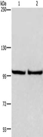 Gel: 6%SDS-PAGE,Lysate: 40 ug,Lane 1-2: Hela cells, HepG2 cells,Primary antibody: CSB-PA063947(EIF4G2 Antibody) at dilution 1/500 dilution,Secondary antibody: Goat anti rabbit IgG at 1/8000 dilution,Exposure time: 1 minute