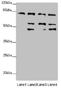 Western blot All lanes: ZFYVE1 antibody at 6.89ug/ml Lane 1: Hela whole cell lysate Lane 2: 293T whole cell lysate Lane 3: Mouse liver tissue Lane 4: Mouse kidney tissue Secondary Goat polyclonal to rabbit IgG at 1/10000 dilution Predicted band si...