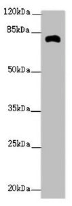 Western blot All lanes: ZFYVE1 antibody at 2.62ug/ml + Mouse kidney tissue Secondary Goat polyclonal to rabbit IgG at 1/10000 dilution Predicted band size: 88, 41, 86 kDa Observed band size: 81 kDa