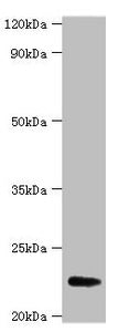 Western blot All lanes: FGF21 antibody at 2µg/ml + A549 whole cell lysate Secondary Goat polyclonal to rabbit IgG at 1/15000 dilution Predicted band size: 23 kDa Observed band size: 23 kDa
