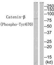 Western blot analysis of extracts from A549 cells, using Catenin-β (Phospho-Tyr670) antibody. The lane on the right is treated with the synthesized peptide.