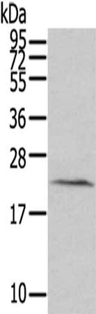 Gel: 12%SDS-PAGE,Lysate: 40 ug,,Primary antibody: CSB-PA064160(HINT3 Antibody) at dilution 1/200 dilution,Secondary antibody: Goat anti rabbit IgG at 1/8000 dilution,Exposure time: 2 minutes