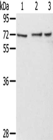 Gel: 8%SDS-PAGE, Lysate: 40 ug, Lane 1-3: Hela cells, hepg2 cells, HT29 cells, Primary antibody: CSB-PA064166(RBBP5 Antibody) at dilution 1/350, Secondary antibody: Goat anti rabbit IgG at 1/8000 dilution, Exposure time: 10 seconds