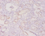 Immunohistochemistry of paraffin-embedded human kidney tissue using CSB-PA06459A0Rb at dilution of 1:20