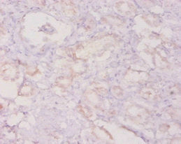 Immunohistochemistry of paraffin-embedded human kidney tissue using CSB-PA06459A0Rb at dilution of 1:20