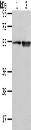 Gel: 8%SDS-PAGE, Lysate: 40 ug, Lane 1-2: TM4 cell and human placenta tissue, Primary antibody: CSB-PA064853(SLC1A1 Antibody) at dilution 1/500 dilution, Secondary antibody: Goat anti rabbit IgG at 1/8000 dilution, Exposure time: 2 minutes