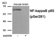 Western blot analysis of extracts from mouse brain tissue using NF- kappaB p65 antibody.The lane on the right is treated with the antigen-specific peptide.