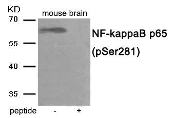 Western blot analysis of extracts from mouse brain tissue using NF- kappaB p65 antibody.The lane on the right is treated with the antigen-specific peptide.