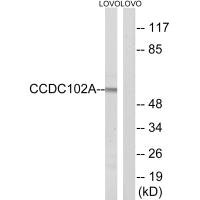 Western blot analysis of extracts from LOVO cells, using CCDC102A antibody.