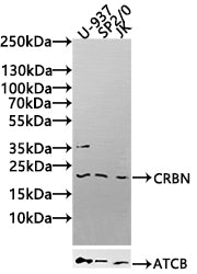 Western Blot Positive WB detected in: U-937 whole cell lysate, SP2/0 whole cell lysate, Mouse Kidney tissue lysate, Rat Liver tissue lysate All lanes: IFNA2 antibody at 1:1000 Secondary Goat polyclonal to rabbit IgG at 1/50000 dilution Predicted b...