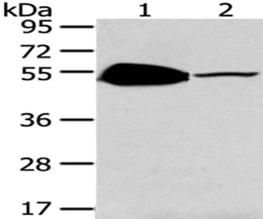 Gel: 8%SDS-PAGE,Lysate: 40 ug,Lane 1-2: Mouse brain tissue, Mouse heart tissue,Primary antibody: CSB-PA065090(TSPYL1 Antibody) at dilution 1/200 dilution,Secondary antibody: Goat anti rabbit IgG at 1/8000 dilution,Exposure time: 2 minutes