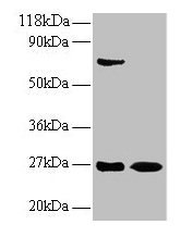 Western blot All lanes: IFNG antibody at 2µg/ml Lane 1: EC109 whole cell lysate Lane 2: 293T whole cell lysate Secondary Goat polyclonal to rabbit IgG at 1/15000 dilution Predicted band size: 20 kDa Observed band size: 27 kDa