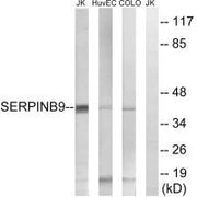 Western blot analysis of extracts from Jurkat cells, using SERPINB9 antibody.