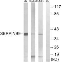 Western blot analysis of extracts from Jurkat cells, using SERPINB9 antibody.