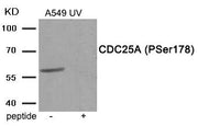 Western blot analysis of extracts from A549 cells treated with UV using Phospho-CDC25A (Ser178) antibody.The lane on the right is treated with the antigen-specific peptide.