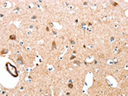 The image on the left is immunohistochemistry of paraffin-embedded Human brain tissue using CSB-PA066208(AARS Antibody) at dilution 1/50, on the right is treated with synthetic peptide. (Original magnification: ×200)