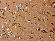 The image on the left is immunohistochemistry of paraffin-embedded Human brain tissue using CSB-PA066402(EDN3 Antibody) at dilution 1/50, on the right is treated with fusion protein. (Original magnification: ×200)