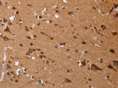 The image on the left is immunohistochemistry of paraffin-embedded Human brain tissue using CSB-PA066402(EDN3 Antibody) at dilution 1/50, on the right is treated with fusion protein. (Original magnification: ×200)