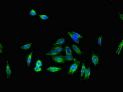 Immunofluorescent analysis of Hela cells using CSB-PA06649A0Rb at dilution of 1:100 and Alexa Fluor 488-congugated AffiniPure Goat Anti-Rabbit IgG(H+L)