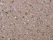The image on the left is immunohistochemistry of paraffin-embedded Human brain tissue using CSB-PA066585(ITGB2 Antibody) at dilution 1/40, on the right is treated with fusion protein. (Original magnification: ×200)