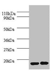 Western blot All lanes: IL1RN antibody at 2µg/ml Lane 1: EC109 whole cell lysate Lane 2: 293T whole cell lysate Secondary Goat polyclonal to rabbit IgG at 1/10000 dilution Predicted band size: 21, 18, 20, 17 kDa Observed band size: 17 kDa