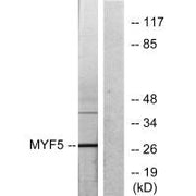 Western blot analysis of extracts from HepG2 cells, using MYF5 antibody.