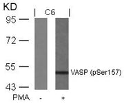 Western blot analysis of extracts from C6 cells untreated or treated with PMA using VASP(Phospho-Ser157) Antibody.