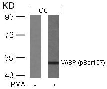 Western blot analysis of extracts from C6 cells untreated or treated with PMA using VASP(Phospho-Ser157) Antibody.