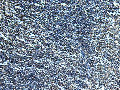 The image is immunohistochemistry of paraffin-embedded Human tonsil tissue using CSB-PA067005 at dilution 1/30. (Original magnification: ×200)