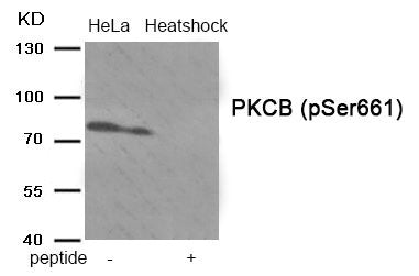 Western blot analysis of extracts from HeLa cells treated with Heatshock using Phospho-PKCB (Ser661) antibody.The lane on the right is treated with the antigen-specific peptide.