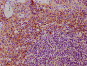 IHC image of CSB-PA06725A0Rb diluted at 1:600 and staining in paraffin-embedded human tonsil tissue performed on a Leica BondTM system. After dewaxing and hydration, antigen retrieval was mediated by high pressure in a citrate buffer (pH 6.0). Sec...