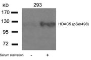 Western blot analysis of extracts from 293 cells untreated or treated with serum starvation using HDAC5(Phospho-Ser498) Antibody.