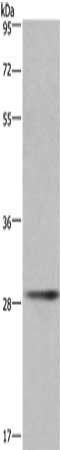 Gel: 8%SDS-PAGE, Lysate: 40 ug, Lane: Mouse liver tissue, Primary antibody: CSB-PA067336(CD40LG Antibody) at dilution 1/300, Secondary antibody: Goat anti rabbit IgG at 1/8000 dilution, Exposure time: 1minute