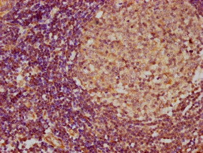 IHC image of CSB-PA06737A0Rb diluted at 1:300 and staining in paraffin-embedded human lymph node tissue performed on a Leica BondTM system. After dewaxing and hydration, antigen retrieval was mediated by high pressure in a citrate buffer (pH 6.0)....