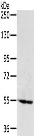 Gel: 6%SDS-PAGE,Lysate: 40 ug,,Primary antibody: CSB-PA067626(SNX1 Antibody) at dilution 1/200 dilution,Secondary antibody: Goat anti rabbit IgG at 1/8000 dilution,Exposure time: 1 minute