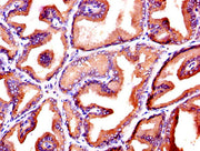 IHC image of CSB-PA06779A0Rb diluted at 1:600 and staining in paraffin-embedded human prostate tissue performed on a Leica BondTM system. After dewaxing and hydration, antigen retrieval was mediated by high pressure in a citrate buffer (pH 6.0). S...
