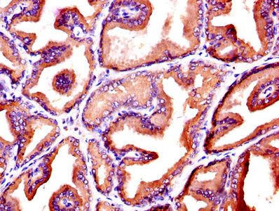 IHC image of CSB-PA06779A0Rb diluted at 1:600 and staining in paraffin-embedded human prostate tissue performed on a Leica BondTM system. After dewaxing and hydration, antigen retrieval was mediated by high pressure in a citrate buffer (pH 6.0). S...