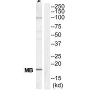 Western blot analysis of extracts from Jurkat cells, using MB antibody.