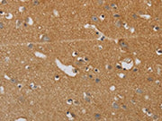 The image on the left is immunohistochemistry of paraffin-embedded Human brain tissue using CSB-PA068103(KIF4A Antibody) at dilution 1/40, on the right is treated with synthetic peptide. (Original magnification: ×200)