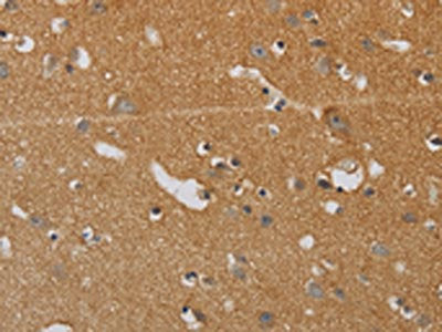 The image on the left is immunohistochemistry of paraffin-embedded Human brain tissue using CSB-PA068103(KIF4A Antibody) at dilution 1/40, on the right is treated with synthetic peptide. (Original magnification: ×200)