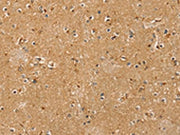 The image on the left is immunohistochemistry of paraffin-embedded Human brain tissue using CSB-PA068151(RASSF1 Antibody) at dilution 1/20, on the right is treated with fusion protein. (Original magnification: ×200)