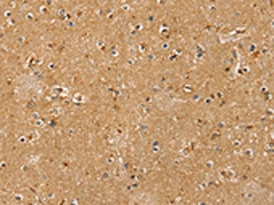 The image on the left is immunohistochemistry of paraffin-embedded Human brain tissue using CSB-PA068151(RASSF1 Antibody) at dilution 1/20, on the right is treated with fusion protein. (Original magnification: ×200)